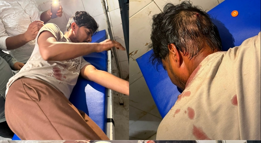 बढ़नी में दुस्साहस: चाय की दुकान पर बैठे युवक पर चाकू से जानलेवा हमला, सिर में गंभीर चोट, मेडिकल कॉलेज रेफर
